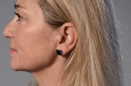 Soňa Klinger first additional image